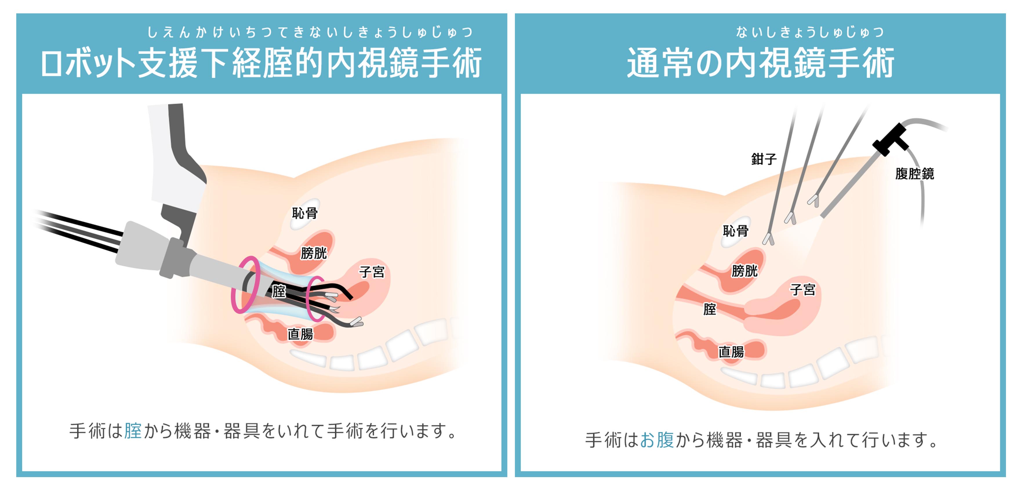 手術比較