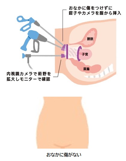 vNOTEs説明付き＋傷なし