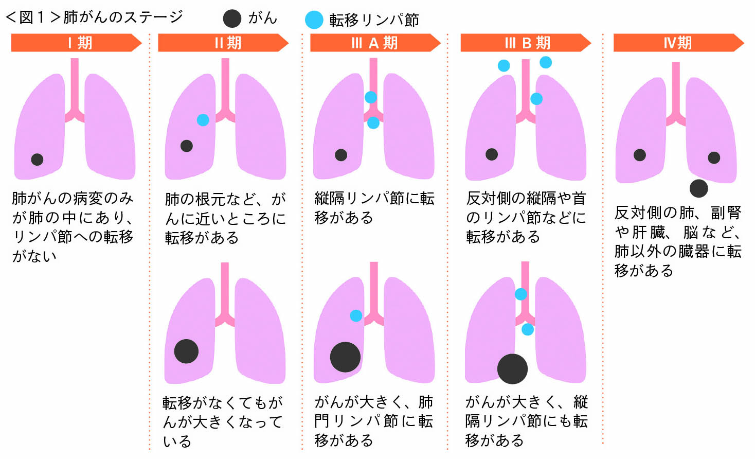 癌 MEDICARE LIGHT すい臓がんリスク腫瘍マーカー検査キット