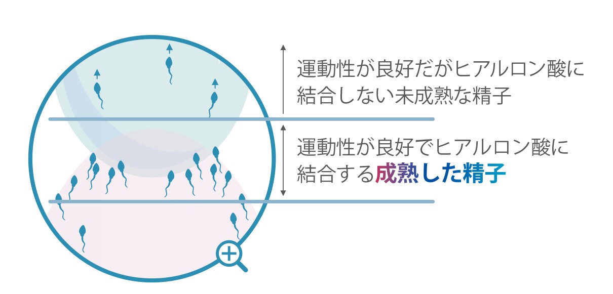 不妊治療先進医療PICSI