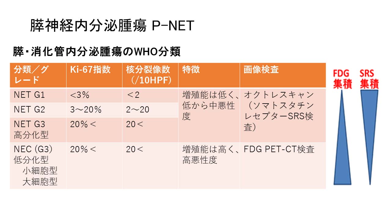 膵神経内分泌腫瘍