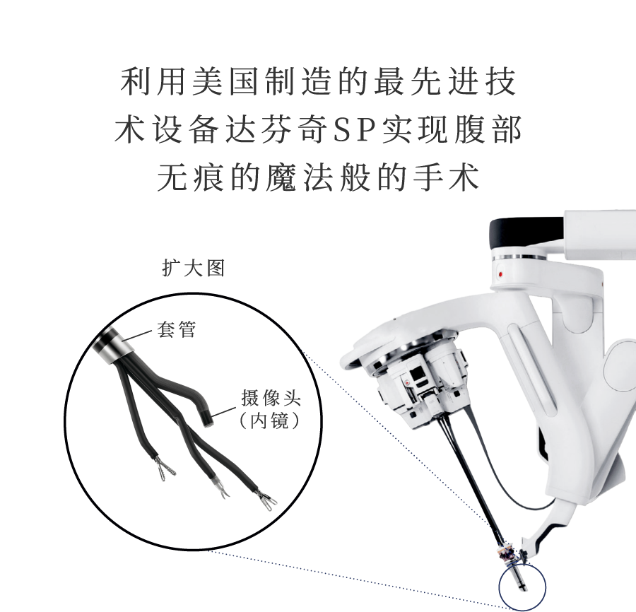 利用美国制造的最先进技 术设备达芬奇SP实现腹部 无痕的魔法般的手术